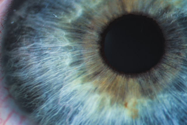 646, 646, An enlarged image of eye with a blue iris, eyelashes and sclera. the shot is made by a slit lamp with a built-in camera, AdobeStock_181546582.jpeg, 82948, https://guestsage.com/wp-content/uploads/2019/10/AdobeStock_181546582.jpeg, https://guestsage.com/technology-description/an-enlarged-image-of-eye-with-a-blue-iris-eyelashes-and-sclera-the-shot-is-made-by-a-slit-lamp-with-a-built-in-camera/, , 3, , An enlarged image of eye with a blue iris, eyelashes and sclera. the shot is made by a slit lamp with a built-in camera, an-enlarged-image-of-eye-with-a-blue-iris-eyelashes-and-sclera-the-shot-is-made-by-a-slit-lamp-with-a-built-in-camera, inherit, 57, 2019-10-09 20:19:14, 2019-10-09 20:29:16, 0, image/jpeg, image, jpeg, https://guestsage.com/wp-includes/images/media/default.png, 640, 427, Array